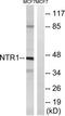 Neurotensin receptor type 1 antibody, TA314293, Origene, Western Blot image 