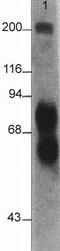L1 Cell Adhesion Molecule antibody, ab24345, Abcam, Western Blot image 