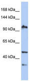 XAB2 antibody, TA339735, Origene, Western Blot image 