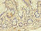 GalNAc-T14 antibody, CSB-PA836212LA01HU, Cusabio, Immunohistochemistry frozen image 