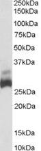 Succinate Dehydrogenase Complex Iron Sulfur Subunit B antibody, PA5-18407, Invitrogen Antibodies, Western Blot image 