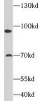 DNA-binding protein SATB2 antibody, FNab07616, FineTest, Western Blot image 
