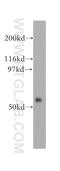 F-Box Protein 15 antibody, 13024-1-AP, Proteintech Group, Western Blot image 