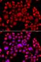 Phosphatidylinositol-5-phosphate 4-kinase type-2 beta antibody, orb373920, Biorbyt, Immunofluorescence image 