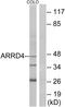 Arrestin Domain Containing 4 antibody, A12500, Boster Biological Technology, Western Blot image 