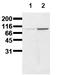 Catenin Beta 1 antibody, AM00015PU-N, Origene, Western Blot image 