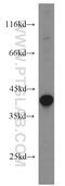 PIH1 Domain Containing 1 antibody, 19427-1-AP, Proteintech Group, Western Blot image 