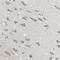Lipoyl synthase, mitochondrial antibody, HPA018842, Atlas Antibodies, Immunohistochemistry paraffin image 