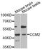 Osm antibody, abx006823, Abbexa, Western Blot image 
