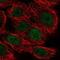 MYC Associated Zinc Finger Protein antibody, NBP2-57338, Novus Biologicals, Immunocytochemistry image 