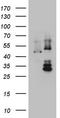 Dolichyl-diphosphooligosaccharide--protein glycosyltransferase 48 kDa subunit antibody, CF803619, Origene, Western Blot image 
