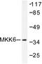 Dual specificity mitogen-activated protein kinase kinase 6 antibody, AP06223PU-N, Origene, Western Blot image 