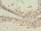 Programmed cell death protein 5 antibody, orb40137, Biorbyt, Immunohistochemistry paraffin image 