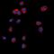 Low Density Lipoprotein Receptor Class A Domain Containing 3 antibody, orb78397, Biorbyt, Immunocytochemistry image 