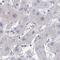 Maestro Heat Like Repeat Family Member 8 antibody, HPA060298, Atlas Antibodies, Immunohistochemistry paraffin image 