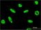 Proline/serine-rich coiled-coil protein 2 antibody, H00196441-M07, Novus Biologicals, Immunocytochemistry image 