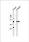 Chromosome transmission fidelity protein 8 homolog antibody, PA5-49525, Invitrogen Antibodies, Western Blot image 