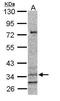 Cysteinyl Leukotriene Receptor 1 antibody, PA5-34635, Invitrogen Antibodies, Western Blot image 