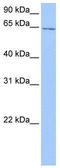 Chromosome 2 Open Reading Frame 42 antibody, TA335531, Origene, Western Blot image 