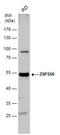 Zinc Finger Protein 556 antibody, GTX116867, GeneTex, Western Blot image 