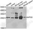 15-Hydroxyprostaglandin Dehydrogenase antibody, A6926, ABclonal Technology, Western Blot image 