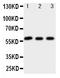Cholesterol 7-alpha-monooxygenase antibody, PA1940, Boster Biological Technology, Western Blot image 
