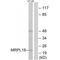 Mitochondrial Ribosomal Protein L18 antibody, A13607, Boster Biological Technology, Western Blot image 