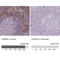 S100 Calcium Binding Protein A4 antibody, AMAb90599, Atlas Antibodies, Immunohistochemistry paraffin image 