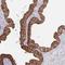 ERC protein 2 antibody, HPA036882, Atlas Antibodies, Immunohistochemistry paraffin image 
