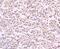 Reelin antibody, A02113, Boster Biological Technology, Immunohistochemistry paraffin image 