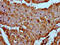 Myozenin 2 antibody, CSB-PA873609LA01HU, Cusabio, Immunohistochemistry paraffin image 