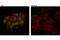 Progesterone Receptor antibody, 8757S, Cell Signaling Technology, Immunofluorescence image 