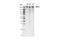 CCR4-NOT Transcription Complex Subunit 1 antibody, 44613S, Cell Signaling Technology, Western Blot image 