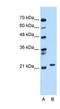 RAB11B, Member RAS Oncogene Family antibody, NBP1-58933, Novus Biologicals, Western Blot image 
