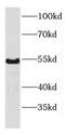 DEAD-Box Helicase 6 antibody, FNab02319, FineTest, Western Blot image 