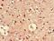 Pim-3 Proto-Oncogene, Serine/Threonine Kinase antibody, orb47119, Biorbyt, Immunohistochemistry paraffin image 