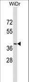 Dual Oxidase Maturation Factor 2 antibody, LS-C159493, Lifespan Biosciences, Western Blot image 