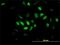Transcription Factor Dp Family Member 3 antibody, H00051270-M01, Novus Biologicals, Immunocytochemistry image 
