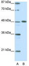 Zinc finger protein ZPR1 antibody, TA343431, Origene, Western Blot image 