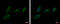 Ectonucleotide Pyrophosphatase/Phosphodiesterase 2 antibody, GTX106209, GeneTex, Immunofluorescence image 
