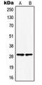Homeobox protein Hox-B5 antibody, MBS821121, MyBioSource, Western Blot image 