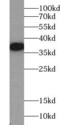 ALK Receptor Tyrosine Kinase antibody, FNab00310, FineTest, Western Blot image 