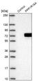 Protein Phosphatase 1 Regulatory Subunit 16A antibody, PA5-54880, Invitrogen Antibodies, Western Blot image 