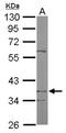 Decaprenyl-diphosphate synthase subunit 2 antibody, NBP1-33199, Novus Biologicals, Immunohistochemistry paraffin image 