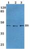 Zinc Finger RANBP2-Type Containing 2 antibody, PA5-36139, Invitrogen Antibodies, Western Blot image 