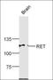 Ret Proto-Oncogene antibody, orb185940, Biorbyt, Western Blot image 