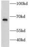 Growth factor receptor-bound protein 10 antibody, FNab03640, FineTest, Western Blot image 