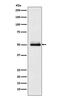 Cytochrome P450 Family 2 Subfamily C Member 9 antibody, M00465-1, Boster Biological Technology, Western Blot image 
