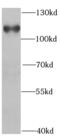 Huntingtin-interacting protein 1 antibody, FNab03870, FineTest, Western Blot image 
