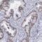Serine/threonine-protein phosphatase 4 regulatory subunit 3B antibody, FNab08024, FineTest, Immunohistochemistry paraffin image 